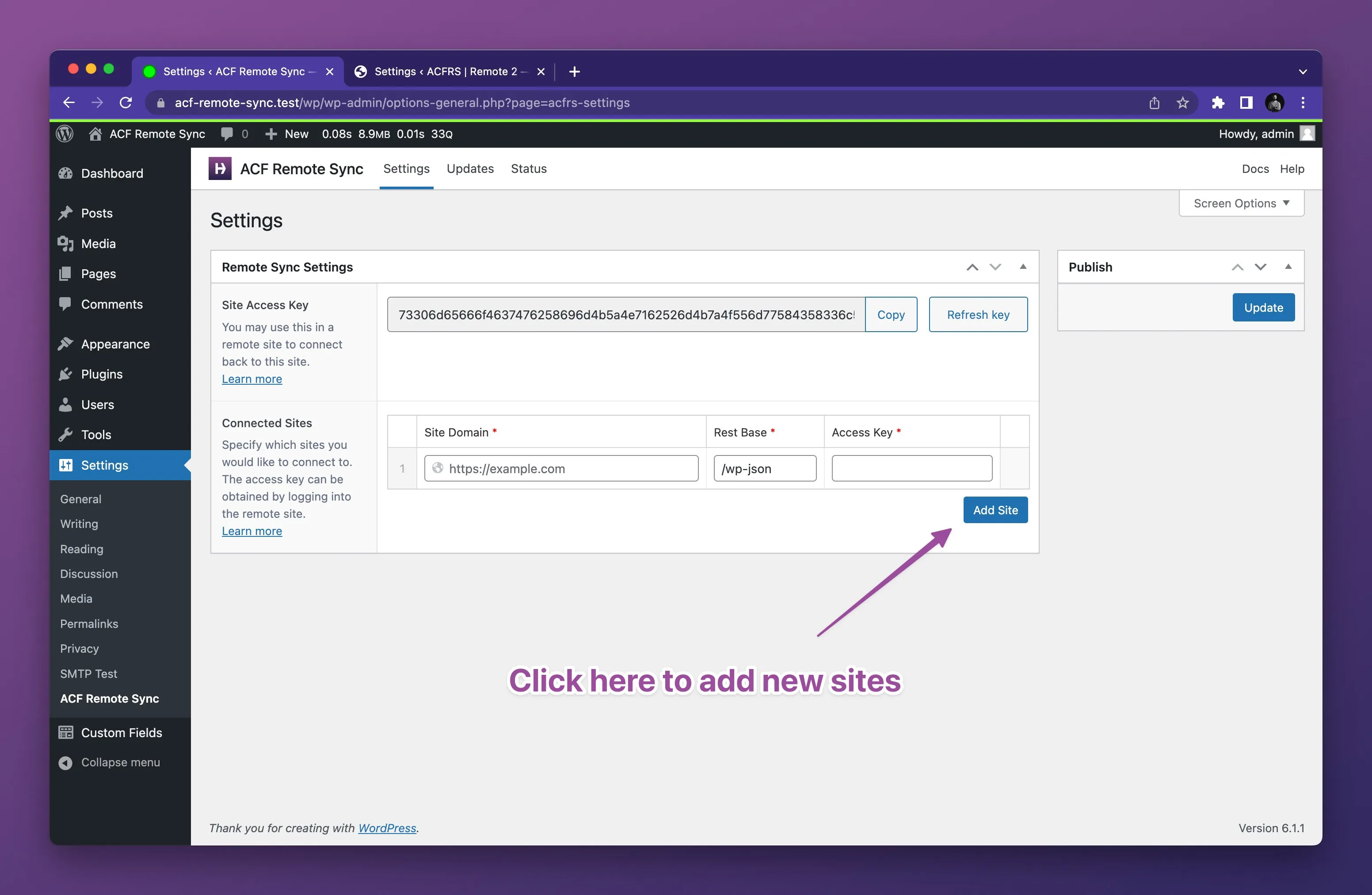 Adding a remote site